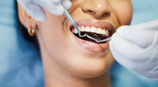 Best Emergency Tooth Extraction in Elmendorf, TX